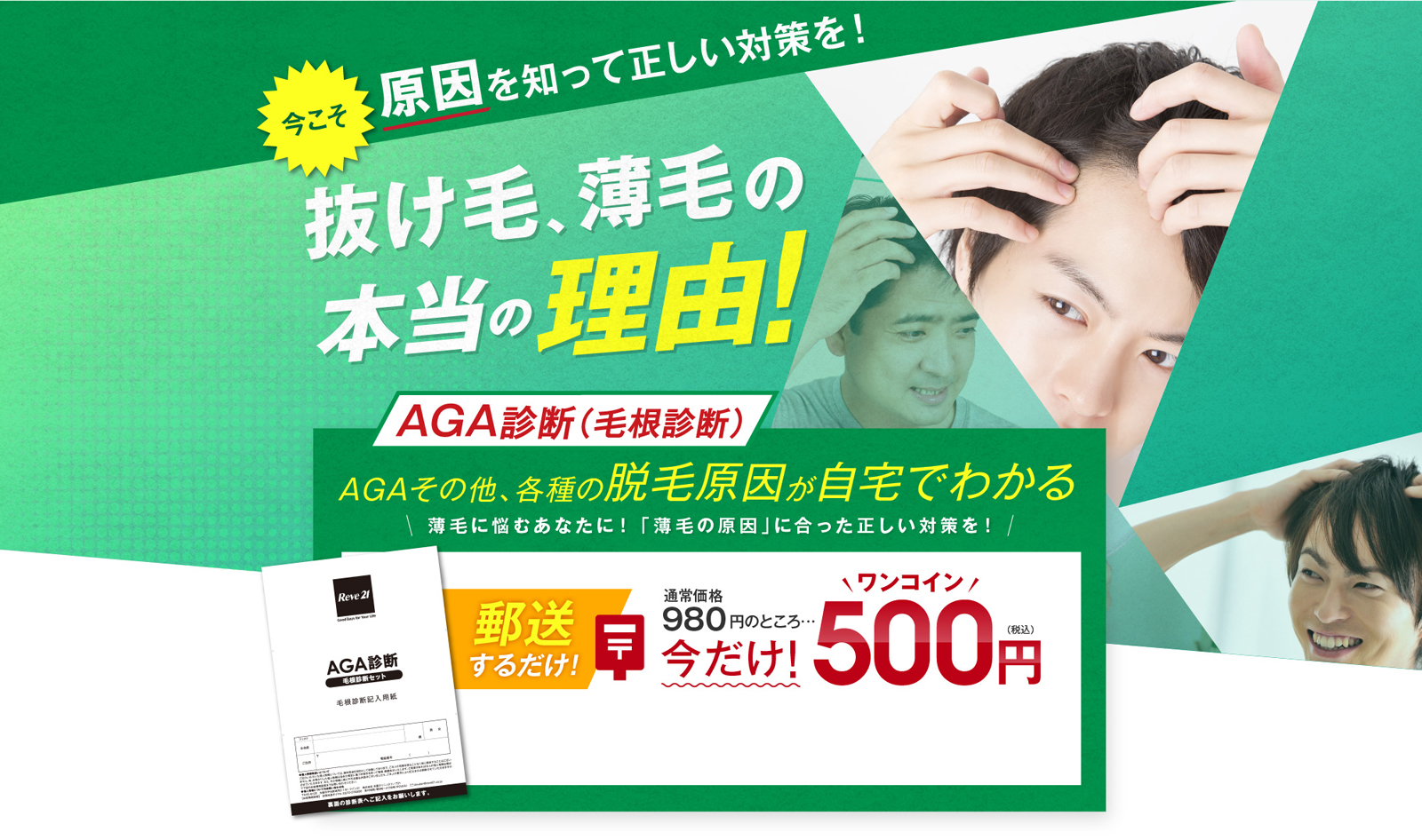 AGA診断ワンコインキャンペーン｜リーブ21